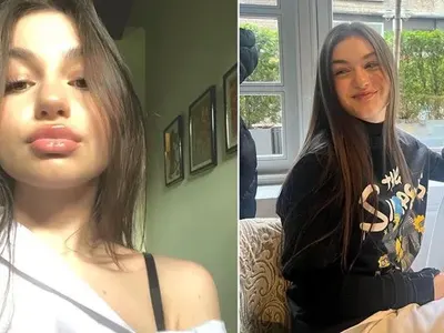 Защо се обезобрази Крисия, защо? Младата певица наду джуките с хиалурон