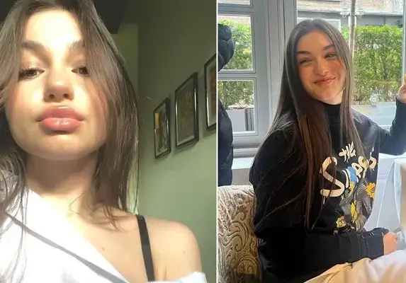 Защо се обезобрази Крисия, защо? Младата певица наду джуките с хиалурон