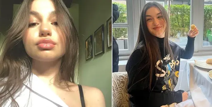Защо се обезобрази Крисия, защо? Младата певица наду джуките с хиалурон