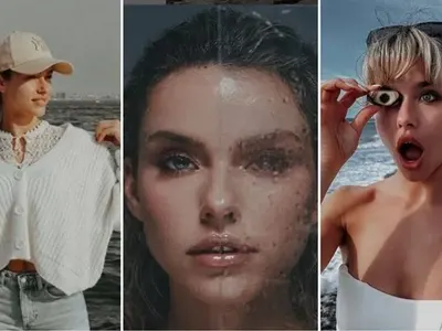 Сети се: Сара на Папи Ханс си оправи зъбите