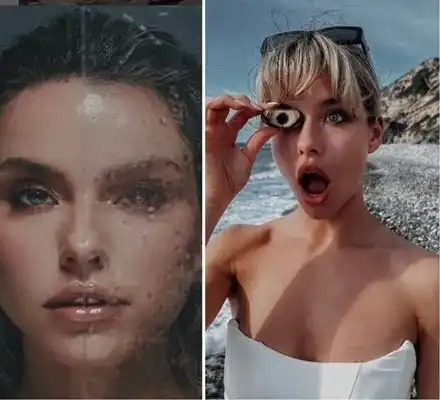 Сети се: Сара на Папи Ханс си оправи зъбите