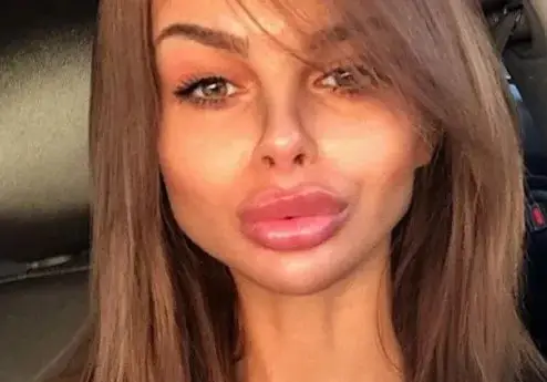 ЧУДО! Сузанита зачева след молитва в църква!