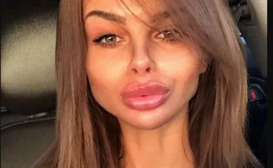 ЧУДО! Сузанита зачева след молитва в църква!