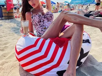 УЖАС: „Мис България”  Радинела Чушева  болна от анорексия (Шок снимки)