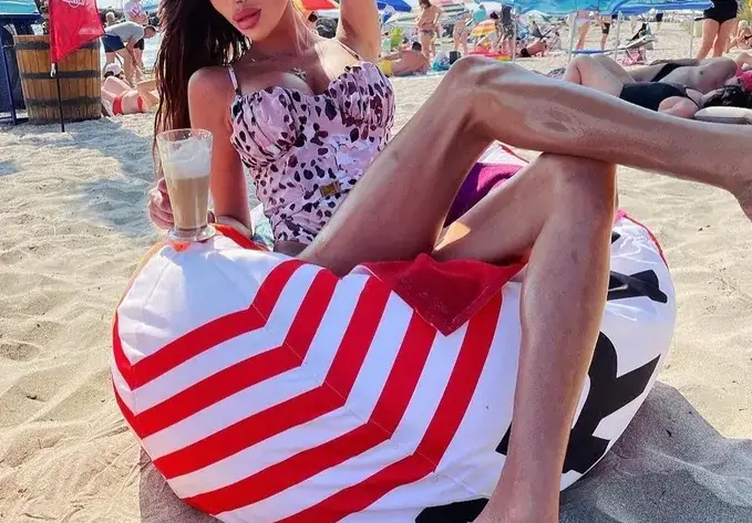 УЖАС: „Мис България”  Радинела Чушева  болна от анорексия (Шок снимки)