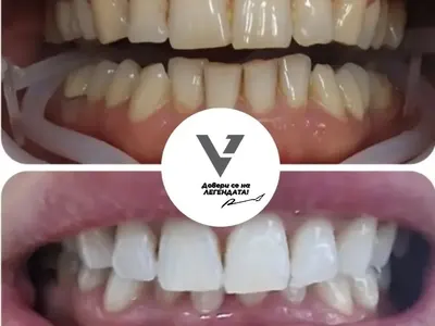 Ванко 1 прави зъби на кредити