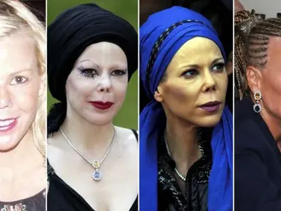 Княгиня Калина жертва на жестока лекарска грешка (Снимки)