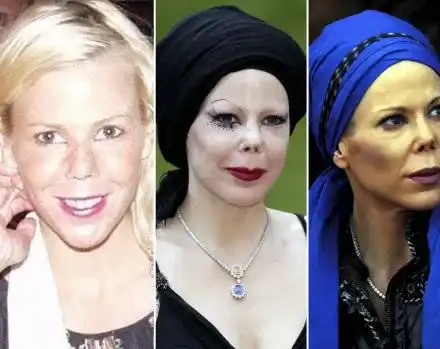 Княгиня Калина жертва на жестока лекарска грешка (Снимки)