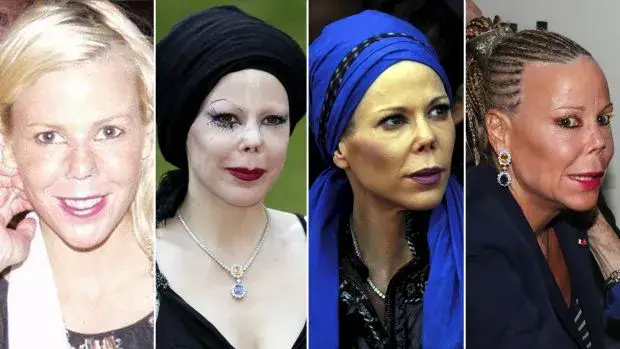 Княгиня Калина жертва на жестока лекарска грешка (Снимки)