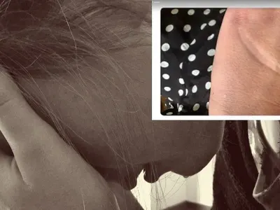 Мис България с разтърсващо признание: Бях на 13, когато ми забиха макетно ножче в ръката! Срамувах се!