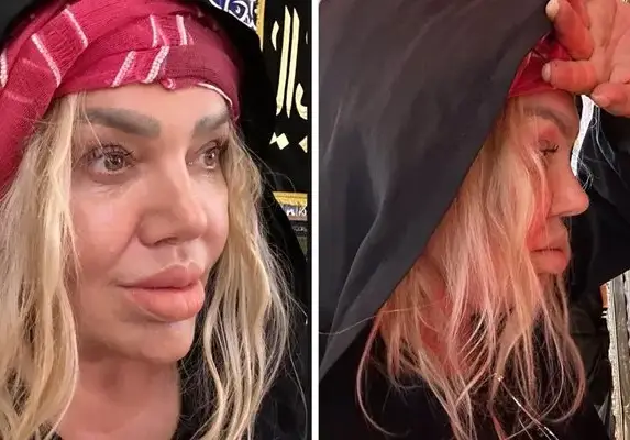 Ваня Червенкова си уголеми устните