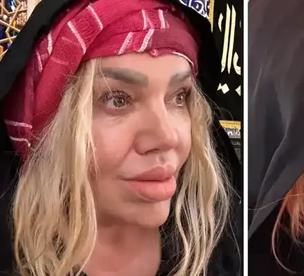 Ваня Червенкова си уголеми устните