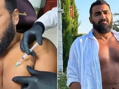 Азис си бие инжекции в гърдите