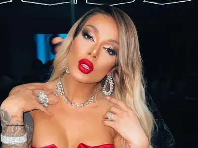 Диона: Аз съм пача със 350 кубика силикон