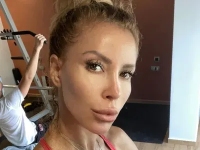 Ирен Онтева си отряза носа  за трети път