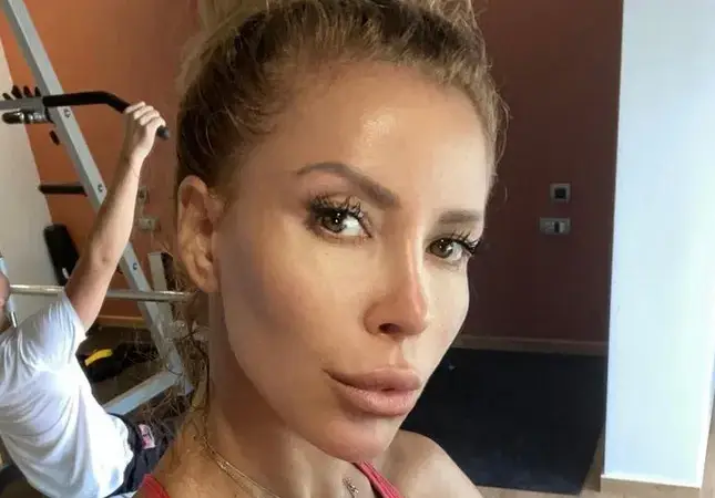 Ирен Онтева си отряза носа  за трети път