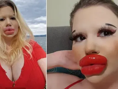 О, Боже! Българското Барби иска да има и най-големите скули в света!