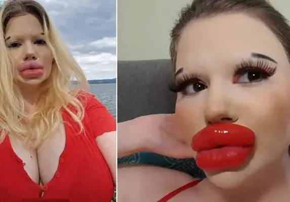 О, Боже! Българското Барби иска да има и най-големите скули в света!