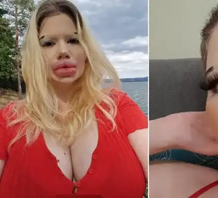 О, Боже! Българското Барби иска да има и най-големите скули в света!