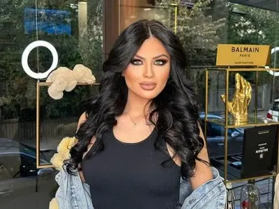 Пълна промяна за Мис България! Тафкова неузнаваема след серия пластични операции? (ФОТО)