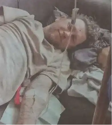 Плачков колабира преди представление