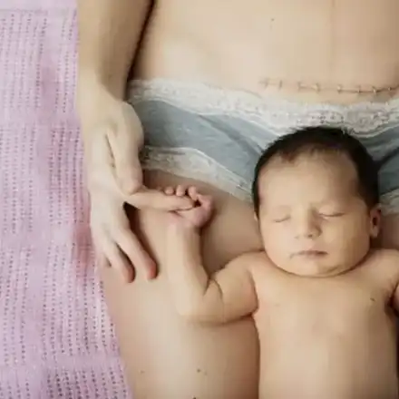 Лекарите мълчат за тези проблеми след цезарово сечение