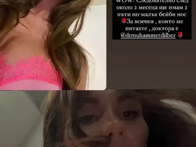 Моника ВалериеВа показа новия нос