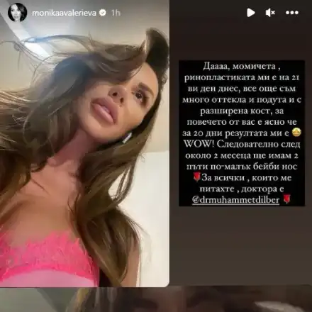 Моника ВалериеВа показа новия нос