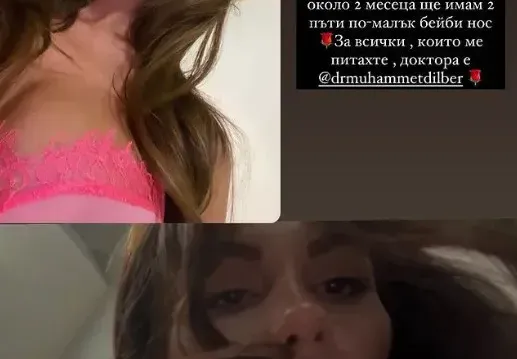 Моника ВалериеВа показа новия нос