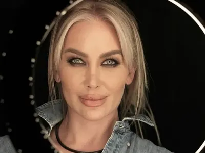 Съвсем се окепази: Тоца изду огромни скули и устни