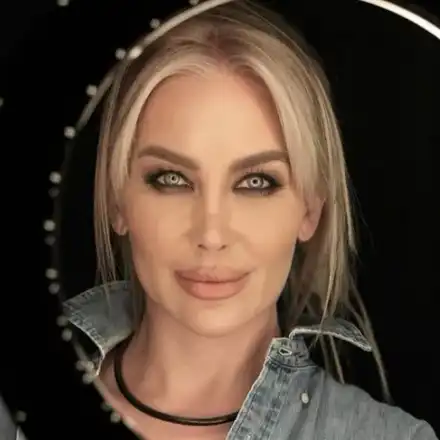 Съвсем се окепази: Тоца изду огромни скули и устни