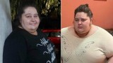 Оперират най-тежката българка Деси от Ловеч