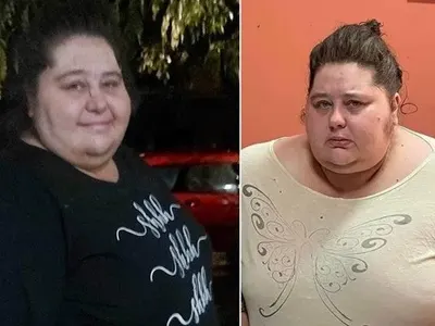 Оперират най-тежката българка Деси от Ловеч