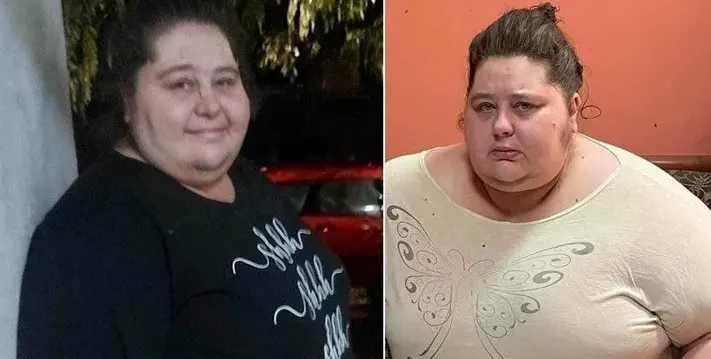 Оперират най-тежката българка Деси от Ловеч