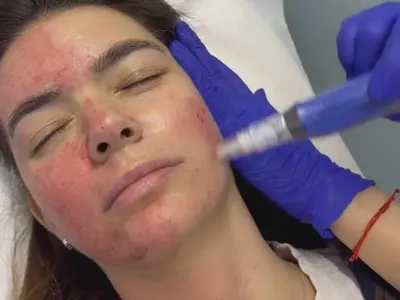 Ива Софиянска заряза бебето и тръгна по процедури СНИМКА