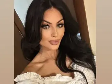 Мис България с нова пластика на лицето! Извая скули като на Николета