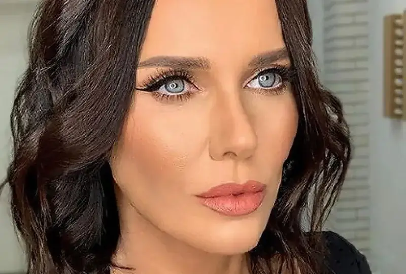 Мария Силвестър се наблъска с ботокс