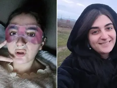 Транссексуалната Петра си направи нова операция