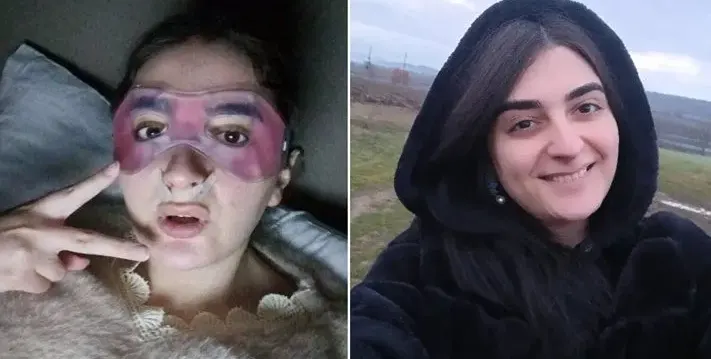 Транссексуалната Петра си направи нова операция