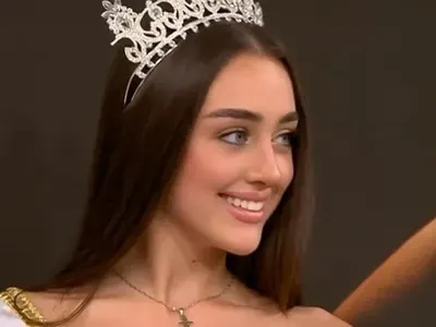 Елизабет Кравец смени веждите