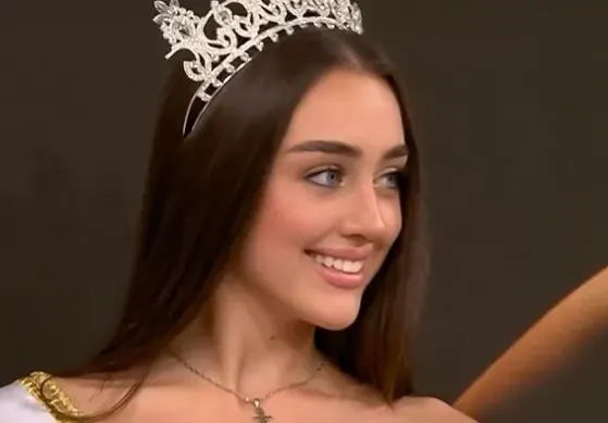 Елизабет Кравец смени веждите