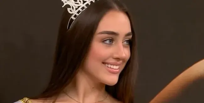 Елизабет Кравец смени веждите