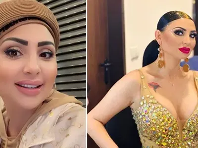 Трепе конкуренцията: Софка легна под ножа, опъна бръчките