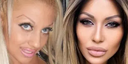 Джулиана Гани иска нов нос, мечтае да е като куклата Барби