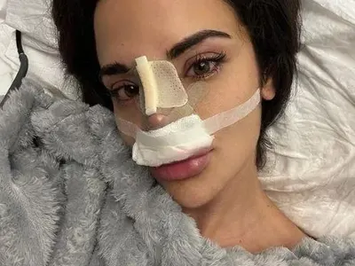 Ивка Бейбе се похвали с поредната пластика: Имам си ново носле! (ФОТО)