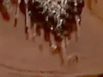 Лъсна увисналата кожа на Мария! Певицата си съсипа корема от липосукции (ШОК СНИМКИ)