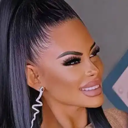 Мис Силикон спаси сокол, храни го със спринцовка (Снимки)