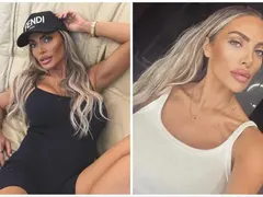 Русата Златка стяга корема с процедури
