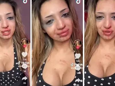 Транссексуалният Даниел: Спукаха ме от бой!