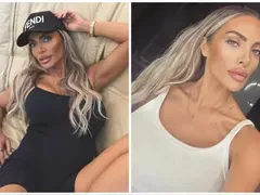 Русата Златка стяга корема с процедури